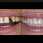 teeth_img
